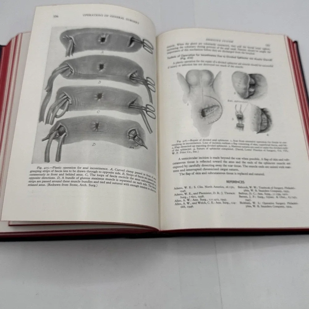 Orr's Operations of‎ General Surgery 2nd Ed 1949 Saunders Medical *READ (e11)